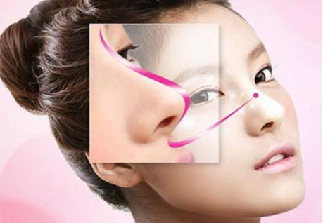 深圳駝峰鼻矯正哪家好？專業(yè)醫(yī)生推薦與真實(shí)案例分享！