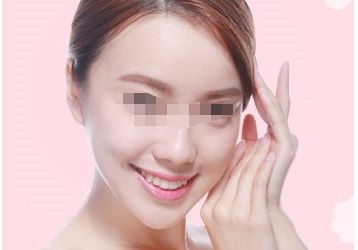 隆鼻手術失敗后的修復方式及風險解析