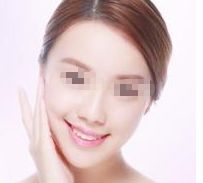 恢復(fù)女性魅力，重塑挺翹胸部的矯正方法