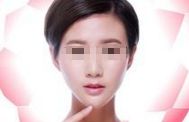 面部吸脂后如何避免松弛與反彈？深度解析！