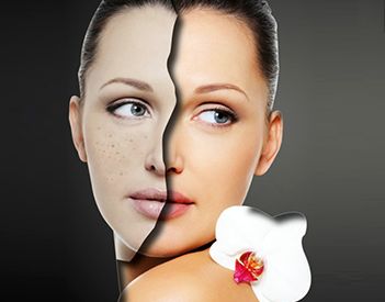 北京雙眼皮修復(fù)的效果如何？什么狀況需要做雙眼皮修復(fù)？