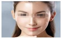 吃海鮮對(duì)于使用瘦腿針的人來(lái)說(shuō)是否適合？