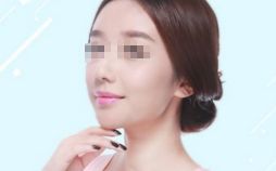雙眼皮修復(fù)，選對(duì)時(shí)機(jī)，展現(xiàn)美麗眼眸