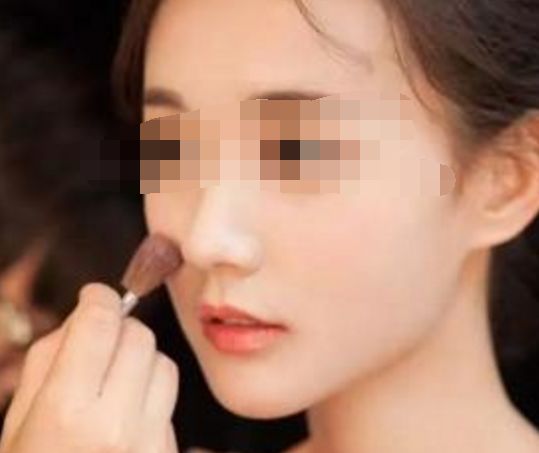 女子臀部整形好風險！整形手術遭不法醫(yī)生用水泥灌注