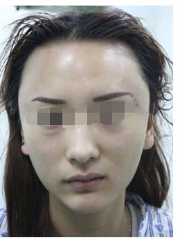 腰腹瘦身術對于塑造體形的有效性