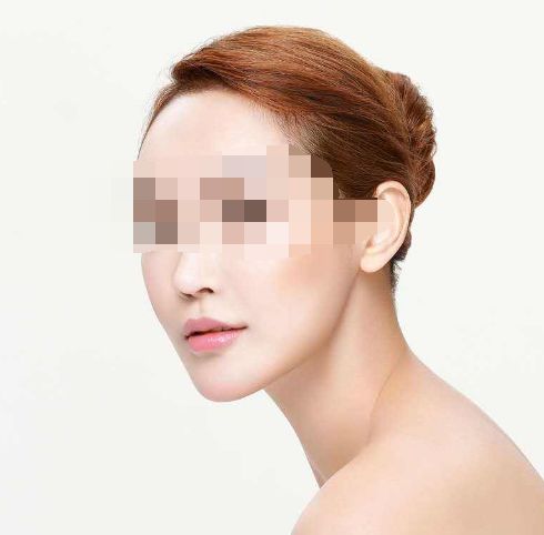 處女膜修復手術成功率及手術過程詳解
