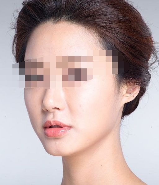 搶拍夏日纖體良方，四大瘦身法解析深度對(duì)比！
