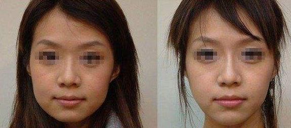 長(zhǎng)期外眼角傷害視力？這樣保護(hù)眼睛更有效！