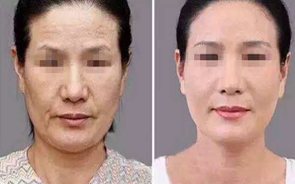 如何讓幼態(tài)臉變得緊致有型？塑造迷人圓潤臉型攻略揭秘！