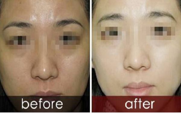 曬黑后如何迅速變白？曬黑美白需要持續(xù)護(hù)理多久結(jié)果可見(jiàn)？了解曬后護(hù)膚科普！