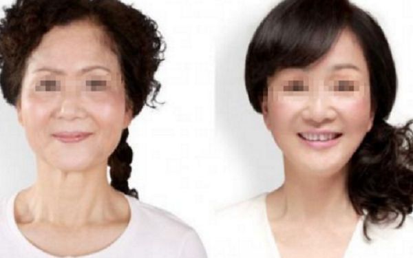 處女膜修補手術(shù)是否需要麻醉？