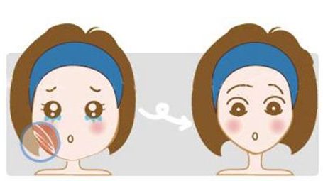 新疆整形醫(yī)院鼻部手術效果如何？預約掛號是否復雜？美麗鼻型展現(xiàn)，了解方法！