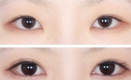 南京中醫(yī)院優(yōu)秀雙眼皮專家推薦，值得信賴！完善的醫(yī)生介紹、項(xiàng)目介紹及價(jià)格表供參考