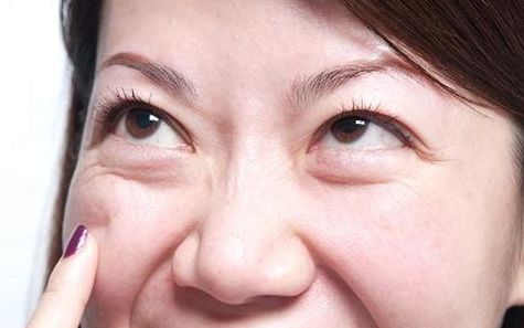 上海九院去眼袋專家推薦，最全擅長項(xiàng)目及費(fèi)用一覽