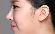 東莞第五人民醫(yī)院美容科綜合評價及專家推薦！
