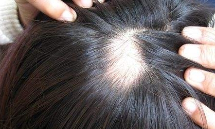 南京新生醫(yī)院植發(fā)效果如何？坐診專家簡介、詳細(xì)地址一覽