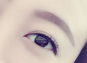 劉春軍豐胸手術(shù)后效果如何？費用怎么樣？醫(yī)生概況+隆胸真實案例圖為參考