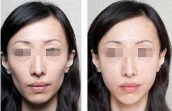 北京頂尖整形醫(yī)院排行榜公布，這三家實(shí)力過硬