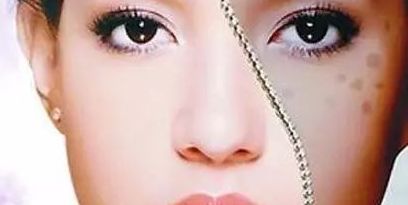 上海眼部修復(fù)專家推薦，治療眼部問題可信賴！