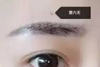 成都江濤雙眼皮術(shù)醫(yī)生坐診地點及案例分析 成都江濤雙眼皮術(shù)醫(yī)生坐診地點及案例分析