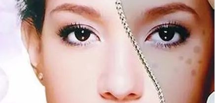 周一雄如何預約雙眼皮手術？案例分享與價格真實評估
