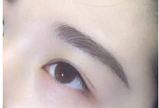 重慶銅雀臺地區(qū)雙眼皮手術(shù)頂級醫(yī)生推薦！詳細收費一覽表