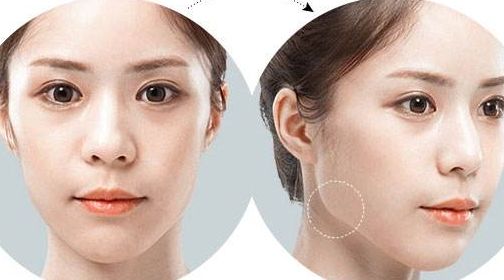 南京乳房美容醫(yī)院推薦，頂級醫(yī)療機(jī)構(gòu)推薦閱讀