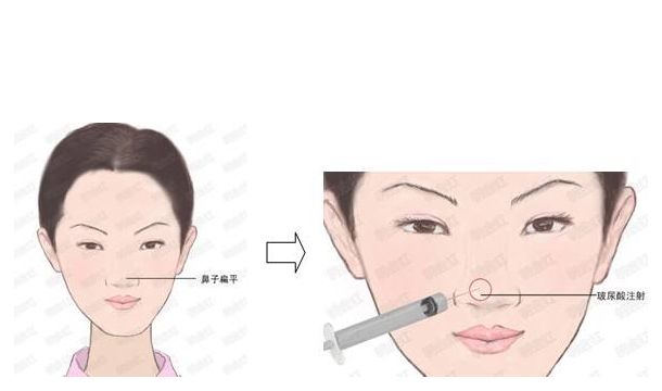 西安美容整形醫(yī)院青睞的五家除皺功效獨(dú)具匠心的佼佼者