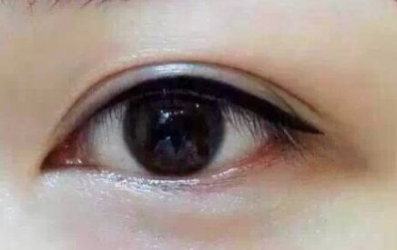 上海9院專家分享軟骨隆鼻案例，LiQingfeng的技術(shù)備受推崇！