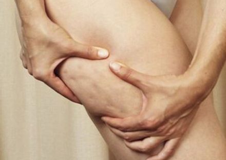 深圳哪家醫(yī)院拉皮手術(shù)效果好？專家推薦米蘭柏羽、美萊、藝星等醫(yī)院