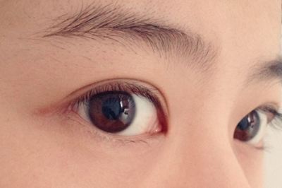 如何選擇適合自己的祛斑醫(yī)院？哪些醫(yī)院是值得嘗試的？