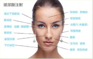 【2024】常州美容整形醫(yī)院最受歡迎的前名單, 限時(shí)搶購中!