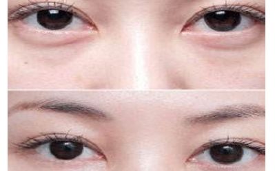 云南雙眼皮醫(yī)生排行榜2023：揭秘5位頂尖專家，讓您輕松煥發(fā)雙目魅力！
