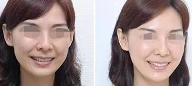 佛山哪家整形醫(yī)院超好的，超皮秒技術(shù)厲害的名單公布