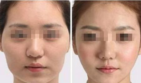 杭州美容整形醫(yī)院排名：一覽無余，了解內(nèi)容不容錯(cuò)過！