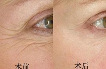 南京鳳凰島整形外科門診部的王科醫(yī)生口碑如何？聯(lián)合李敏醫(yī)生介紹及手術(shù)后的反饋，揭秘這位醫(yī)生的實力！