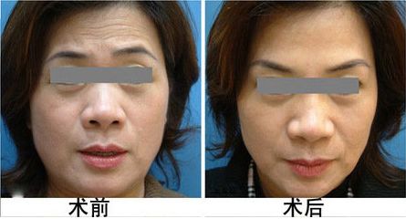 廣安阿藍醫(yī)院整形科評價，是否正規(guī)？地址詳細一覽