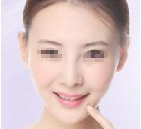 廣州中醫(yī)藥大學(xué)順德醫(yī)院整形美容科2023新趨勢解析 廣州中醫(yī)藥大學(xué)順德醫(yī)院整形美容科2023新趨勢解析