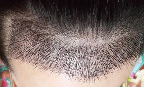 蒲城縣醫(yī)院簡介：如何了解蒲城縣醫(yī)院的特色服務(wù)與專業(yè)醫(yī)療團隊？