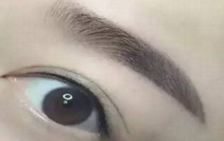 哈爾濱醫(yī)科大學二院最新整形去痦子技術揭秘，讓肌膚恢復純凈光潔