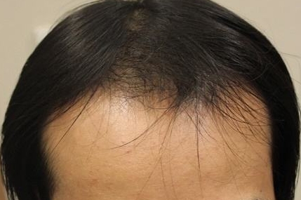 哪家醫(yī)療整形醫(yī)院是貴陽省內(nèi)口碑比較好的選擇？