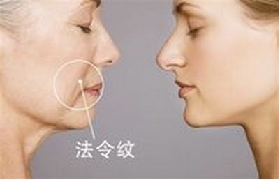 美麗改變，趙德星鼻子整形前后對(duì)比，驚艷有度！