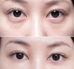 上海美萊醫(yī)院的療效一流，備受好評的醫(yī)生大揭秘！