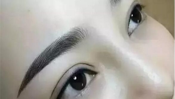 重慶曹陽(yáng)的鼻子整形效果如何？醫(yī)生手藝獨(dú)步天下的真實(shí)案例分享