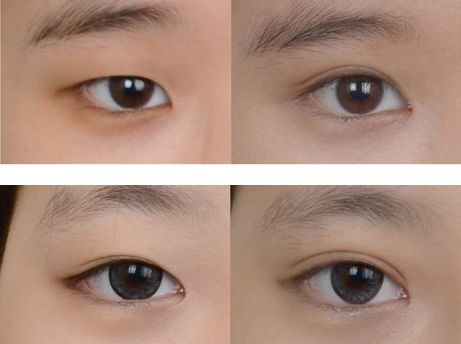 無錫坤如瑪麗醫(yī)院整形價(jià)格及醫(yī)生評價(jià)綜述