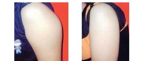 上海九院的整形價格表是怎樣的？它適合想要變美的人嗎？