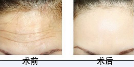 北京協(xié)和整形科的醫(yī)術(shù)高超，專家團(tuán)隊(duì)實(shí)力強(qiáng)大，您值得信賴
