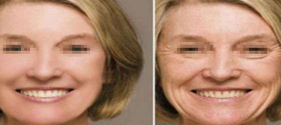 大連許英醫(yī)療美容如何？找到適合你的完美美容之處