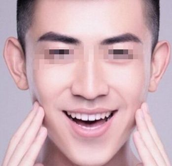北京治疤痕手術(shù)哪家醫(yī)院好？