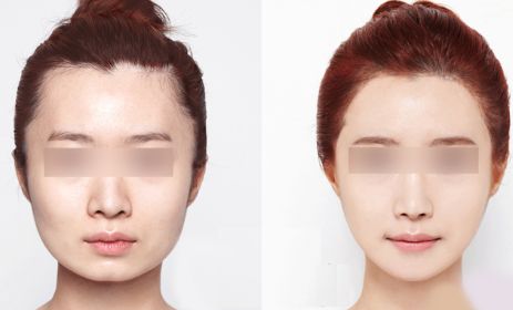 昆明哪里有最好的眼部手術(shù)整形醫(yī)院？2024年10家排名搶先曝光！